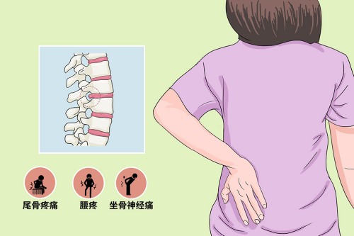 腰椎间盘突出十大禁忌是什么 腰椎间盘突出可以同房吗